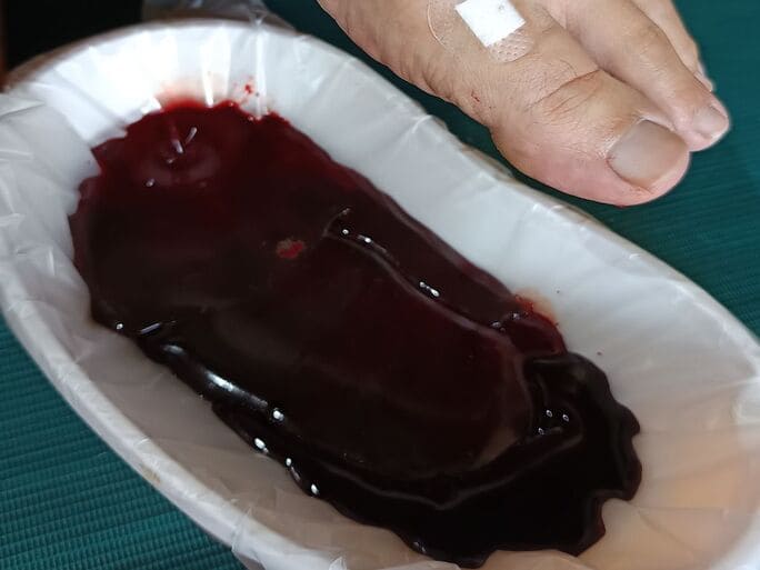Fashdu terapi keseimbangan darah