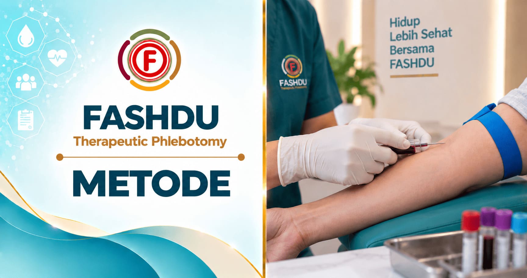 Apa Itu Fashdu? Flebotomi Terapeutik