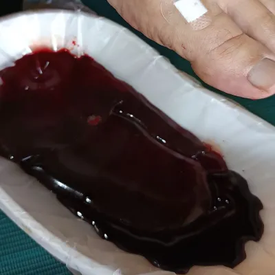 Fashdu kaki kebas dan berat