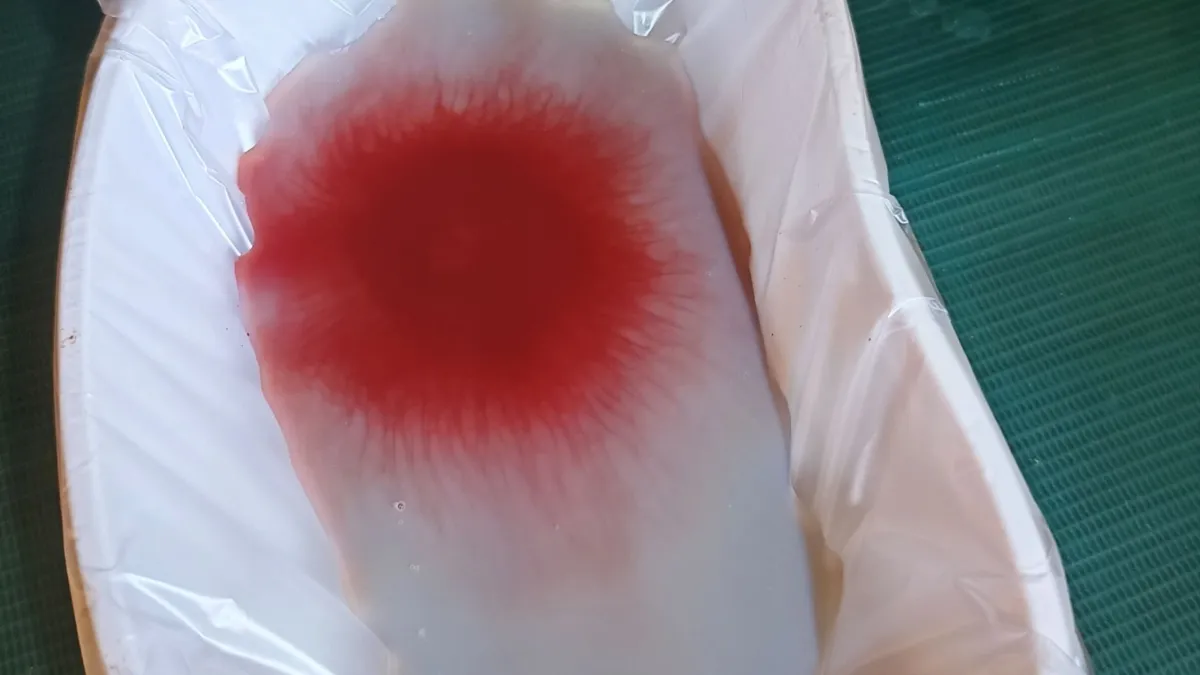 Hasil terapi fashdu keluhan pusing