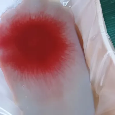 Hasil terapi fashdu keluhan pusing